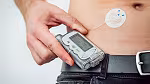 Control of dosing systems