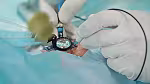 Measurement of flushing fluid pressure